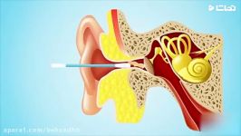 هشدار هرگز گوشتان را گوش پاک کن تمیز نکنید