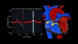 انیمیشن تغییرات ECG در سیستول دیاستولECG Animation  Electrical Changes in Heart animation