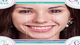 طراحی لبخند  دندانپزشکی سیمادنت