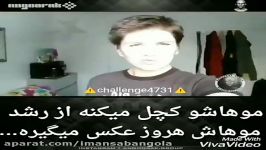 موهاشو کچل میکنه رشد موهاش هر روز عکس میگیره..