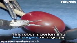 This Surgery Robot Can Effortlessly Suture And Tie Knots