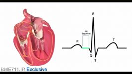 cardiac conditions system