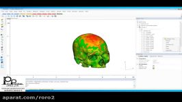 How to Analyze Wall Thickness in the Mimics Innovation