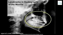 ORAL RADIOLOGY Landmarks in Intraoral and Panoramic