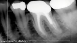 Endodontic Radiographs