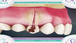 انیمیشن دندانپزشکی  دندانپزشکی سیمادنت