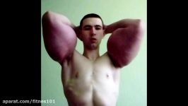 Russian Synthol Guy Gets Implants