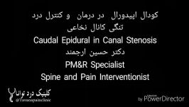 کودال اپیدورال در درمان کنترل درد تنگی کانال نخاع