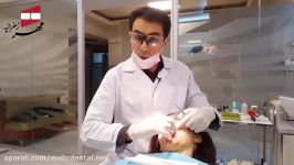 روکش ایمپلنت  کلینیک دندانپزشکی مهر زعفرانیه