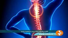 گزارش شبکه خبر در مورد انحراف ستون فقرات