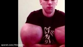 Russian Synthol Guy Gets Implants