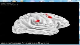 NeuroGuide Brain Surfer Surface Projection