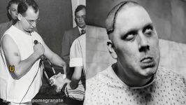 Worst Psychiatric Treatments Throughout History