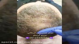 مرکز تخصصی میکرواسکالپ مریم آیرملو 02122372032