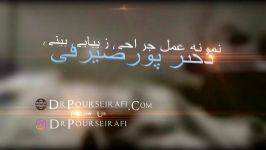 نمونه جراحی بینی ، دکتر علیرضا پور صیرفی