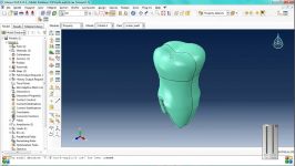 3D Modeling and Stress Analysis of tooth Using FEAAbaqus