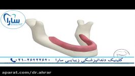 انواع پروتزهای دندانی