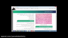 فیلم تطابق آزمون 96 درس پاتولوژی  سوال 12