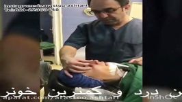 نمونه عمل جراحى بسته بینى توسط دكتر اشترى