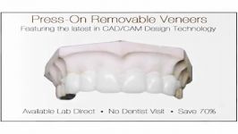 Snap On Smile Alternative in Indianapolis IN  Press On Veneers.com