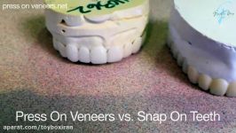 Snap On Smile vs. Press On Veneers  Smile Makeovers Compared
