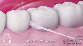 روش صحیح استفاده نخ دندان  دندانستان