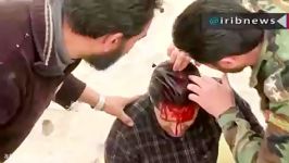 زخمی شدن خبرنگار خبرگزاری صدا سیما در غوطه دمشق