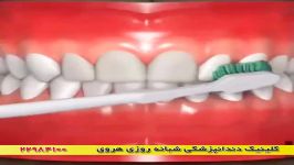 تمیز کردن دندان  بهداشت دهان دندان