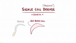بیماری سلول های خونی داسی شکل