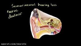 Cochlear implants  Processing the Environment  MCAT  Khan Academy