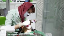 بلیچینگ در کلینیک تخصصی دندانپزشکی دیبا