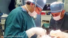 جراحی زیبایی لیفت کامل صورت توسط دکتر سینا غیاثی حافظی 