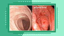 یبوست عواقب جبران ناپذیر آن...