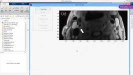 فیلم پروژه تصحیح شدت ناهمگن در تصاویر MRI MR MATLAB