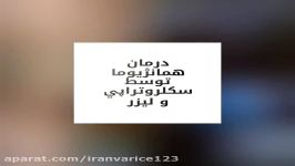 لیزر اسکلروتراپی برای درمان همانژیوما